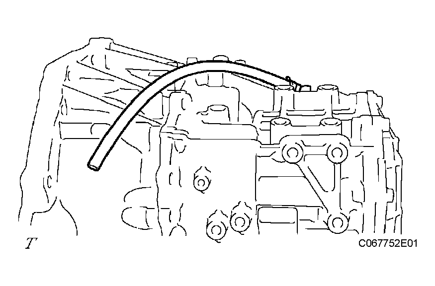 G04154253