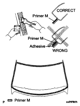 G04967158