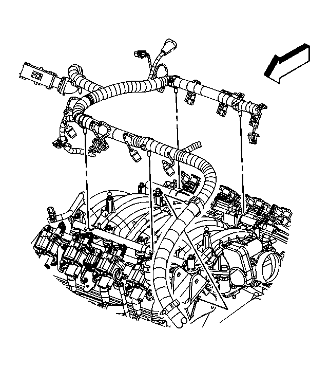 GM1551869