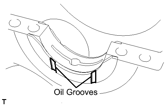 GTY145388